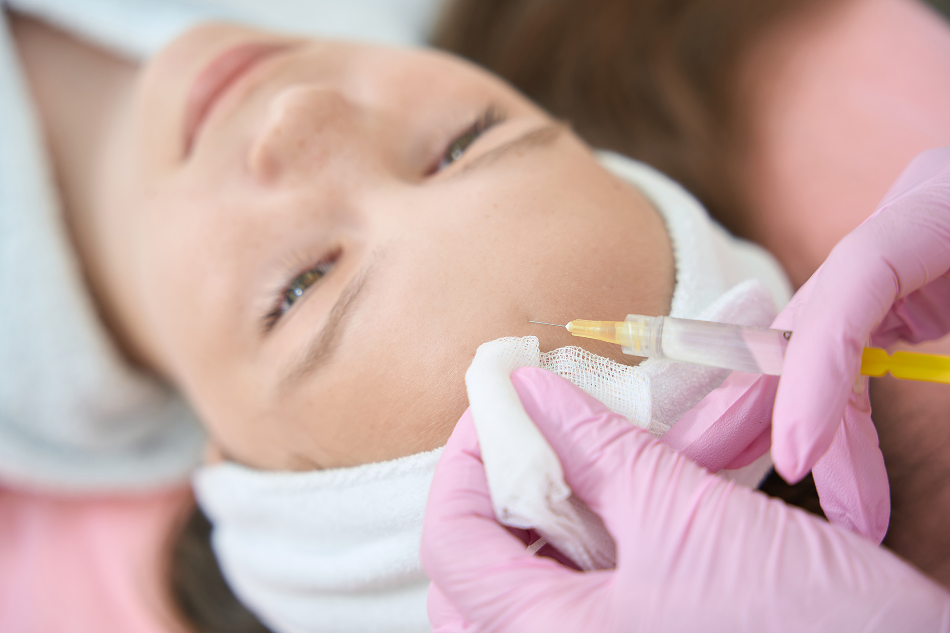 mesoterapia